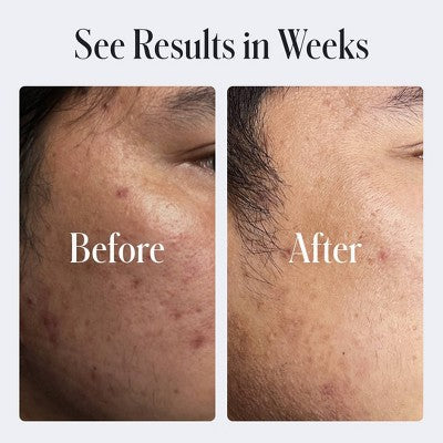 Geologie Clear System Clear Skin Face Cream 2 fl oz - Imperfect Box