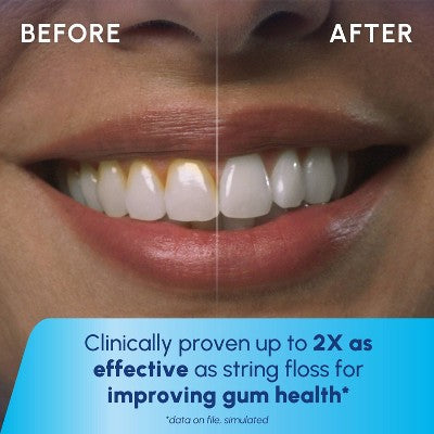 Waterpik Cordlss Plus Water Flosser - Imperfect Box