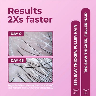 BosleyMD Revive + Densifying Hair Regrowth Serum for Women 1 fl oz - Imperfect Box